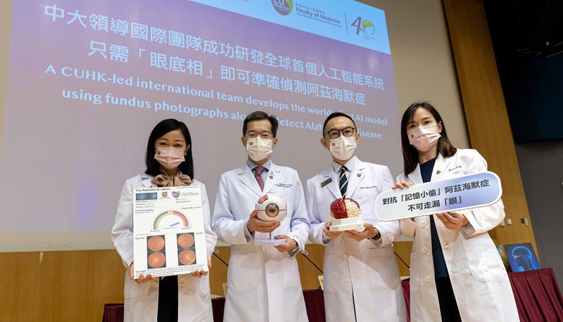 A CUHK-led international team has successfully developed the world’s first AI model that can detect Alzheimer’s disease solely through fundus photographs.