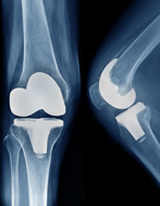 Aging, Skeletal Degeneration and Regeneration