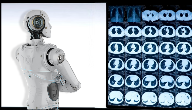 CU Medicine develops an AI-powered analytic tool for lung cancer immunotherapy. 