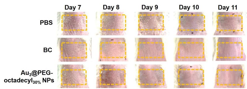 Mice trials suggest that the new nanoparticle has improved the skin condition without wrinkles, compared with standard topical steroid and vitamin D analog-based therapies.