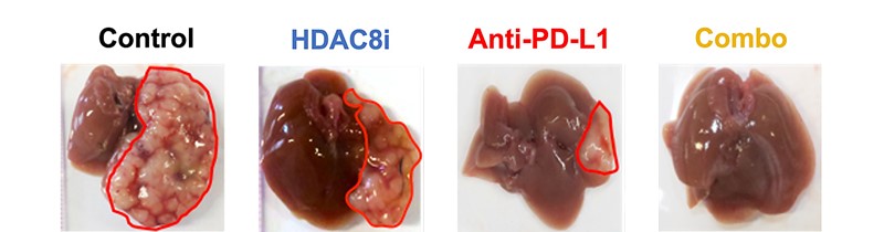 Dissection reveals that when mice are given one form of treatment, the cancer shrinks but remains present on the liver. When mice are given both immunotherapy and epigenetic treatment, the cancer is eradicated, leaving only a perfectly healthy liver, which can recover.