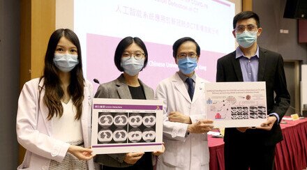 CUHK Research Team Develops an AI System for Detecting COVID-19 Infections in CT with a Privacy Preserving Multinational Validation Study