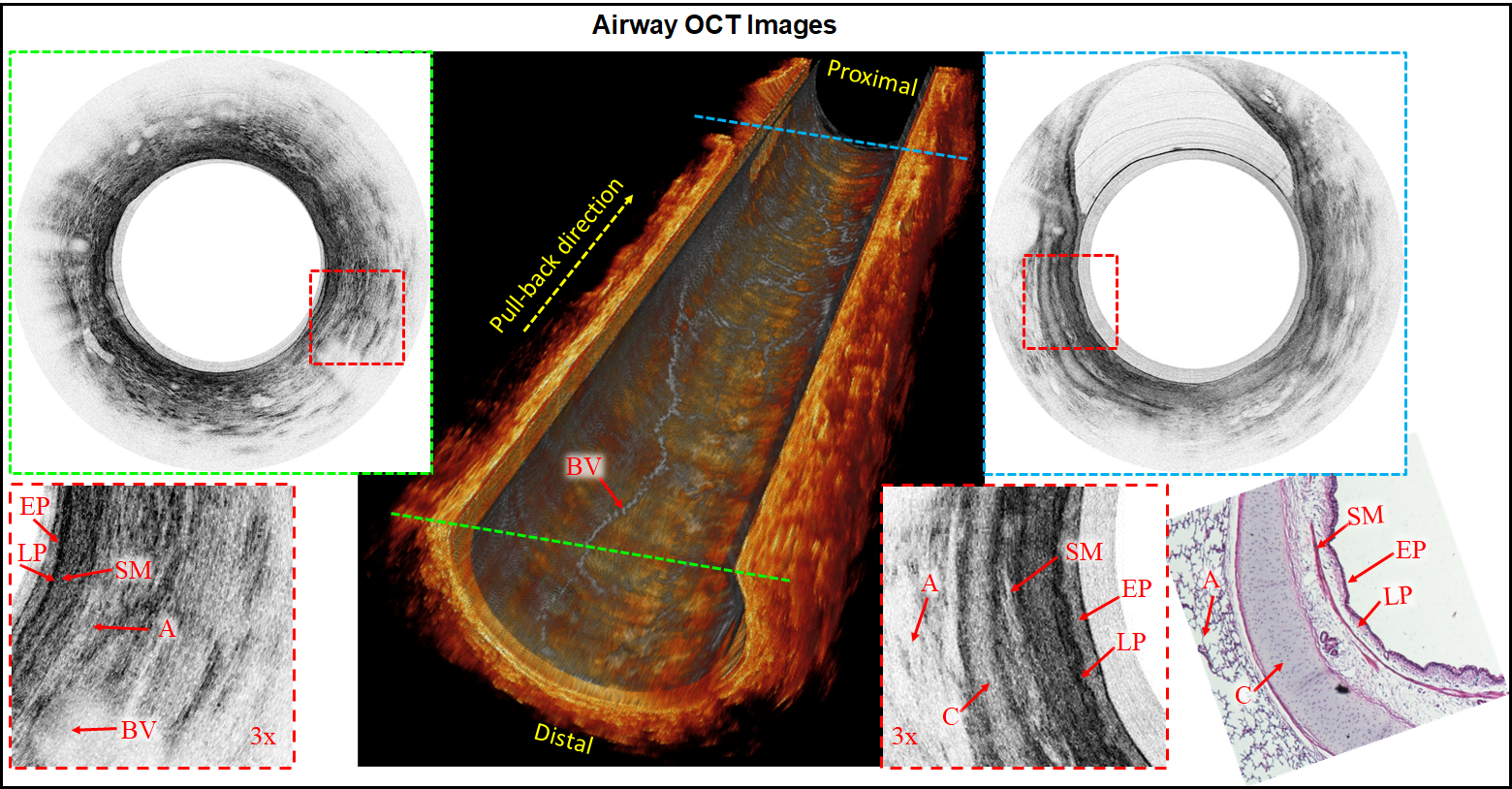 airway OCT