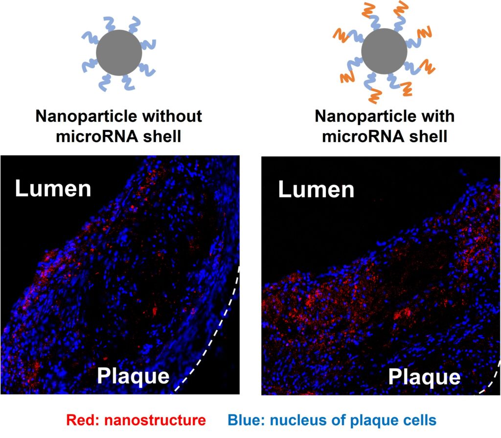 The outer microRNA shell promotes the delivery of nanoparticles to the plaque upon intravenous injection into mice with atherosclerosis.