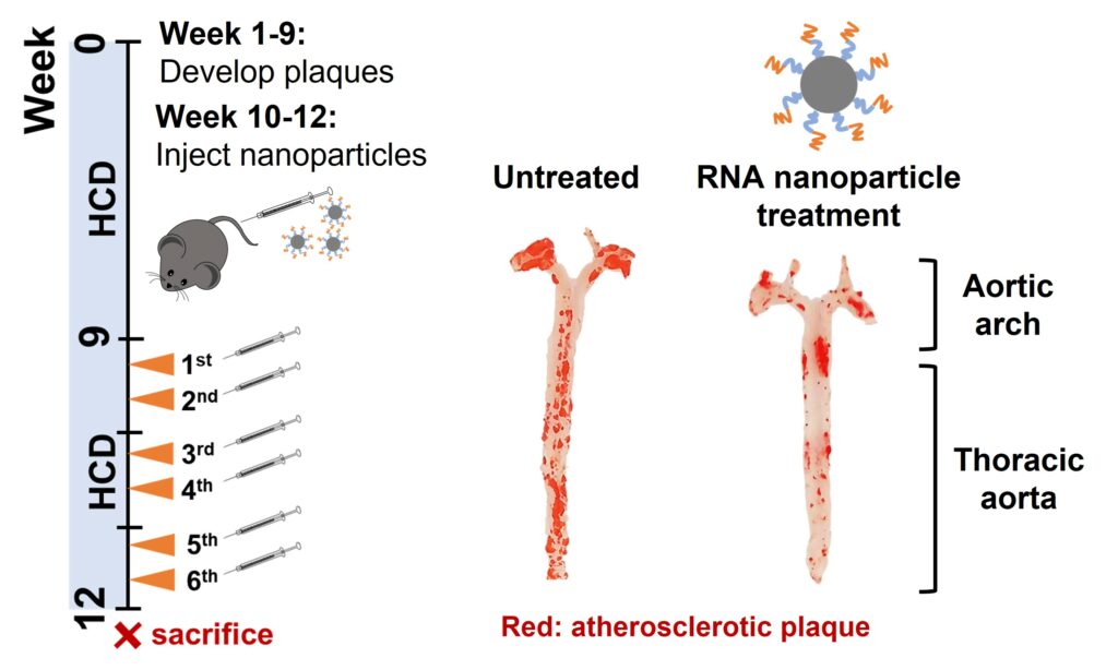 Repeated intravenous injections of RNA nanoparticles into mice with atherosclerosis reduced the atherosclerotic plaque area in the aorta by about 30%.