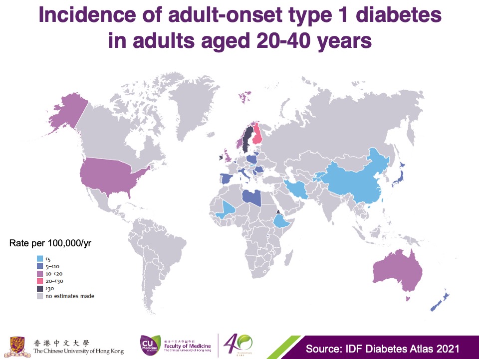 Global pattern of incidence of adult-onset type 1 diabetes in ages 20 to 40