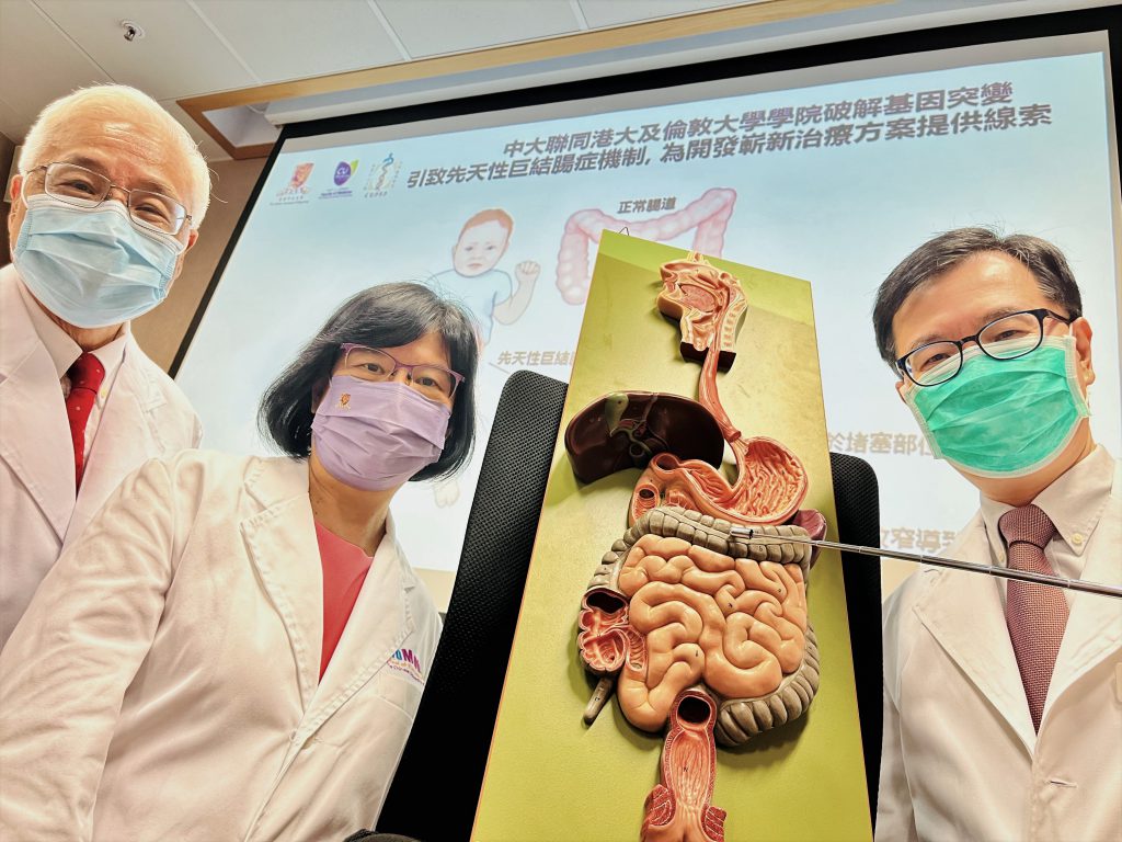 中大副校長岑美霞教授（中）連同中大醫學院生物醫學學院教授陳活彜教授（右），以及港大醫學院小兒外科講座教授譚廣亨教授（左），與英國倫敦大學學院兒童健康研究所合作研究發現，為帶有Sox10基因突變的先天性巨結腸症患者，補充負責調節腸道神經細胞早期發育的「鈣黏蛋白-19」，或有望成為嶄新的治療方向。