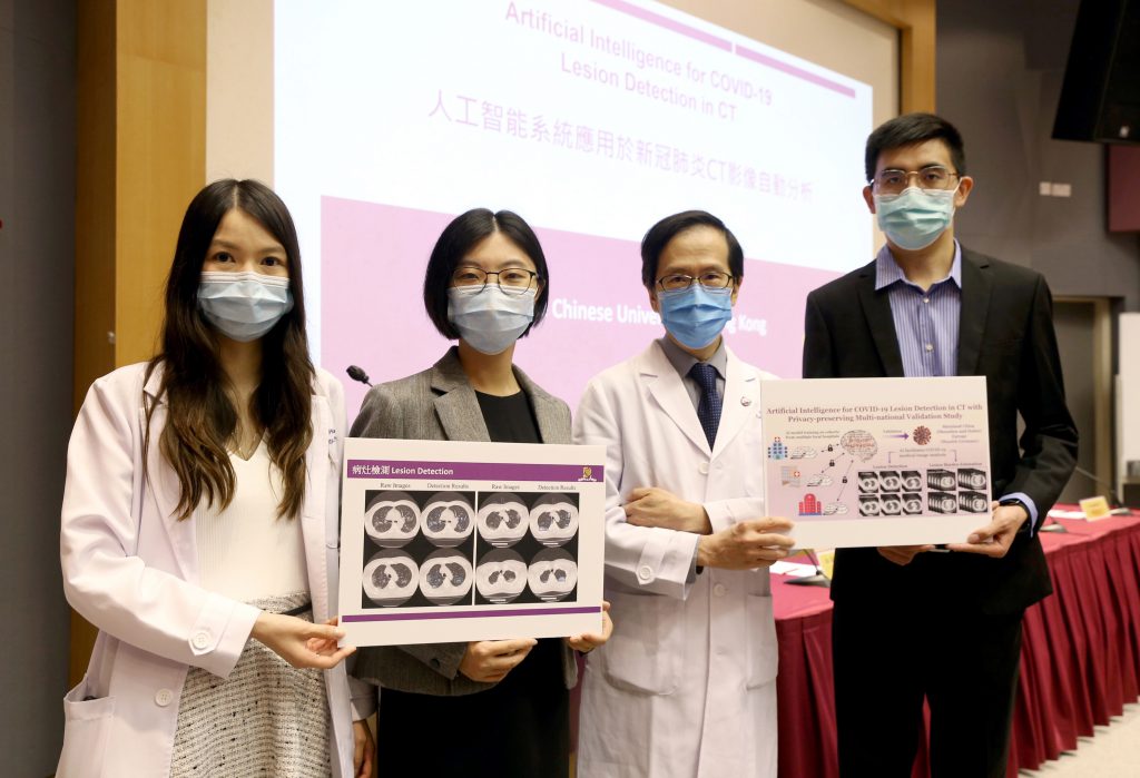 A multidisciplinary research team from CUHK has developed an artificial intelligence (AI) system for the automated, rapid and accurate detection of COVID-19 infections in chest computed tomography (CT) images. <br />
The research team includes: Mr. Quande LIU (1st from right), PhD student, and Prof. Qi DOU (2nd from left), Assistant Professor, Department of Computer Science and Engineering; and Dr. Tiffany SO (1st from left), Assistant Professor, and Prof. Simon YU (2nd from right), Chairman, Department of Imaging and Interventional Radiology, Faculty of Medicine; CUHK.