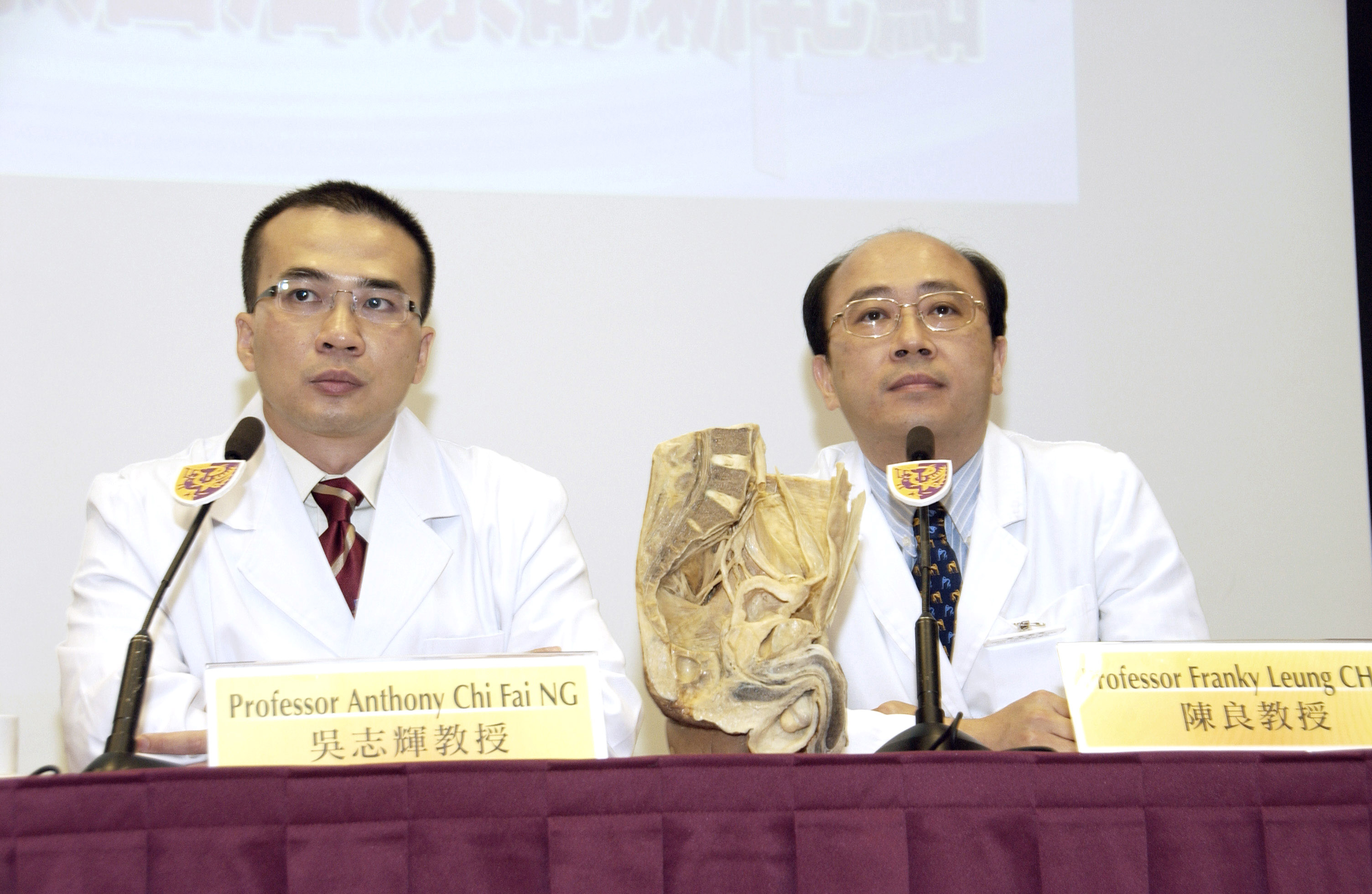 Professor Anthony Ng (left) and Professor Franky Chan (right).