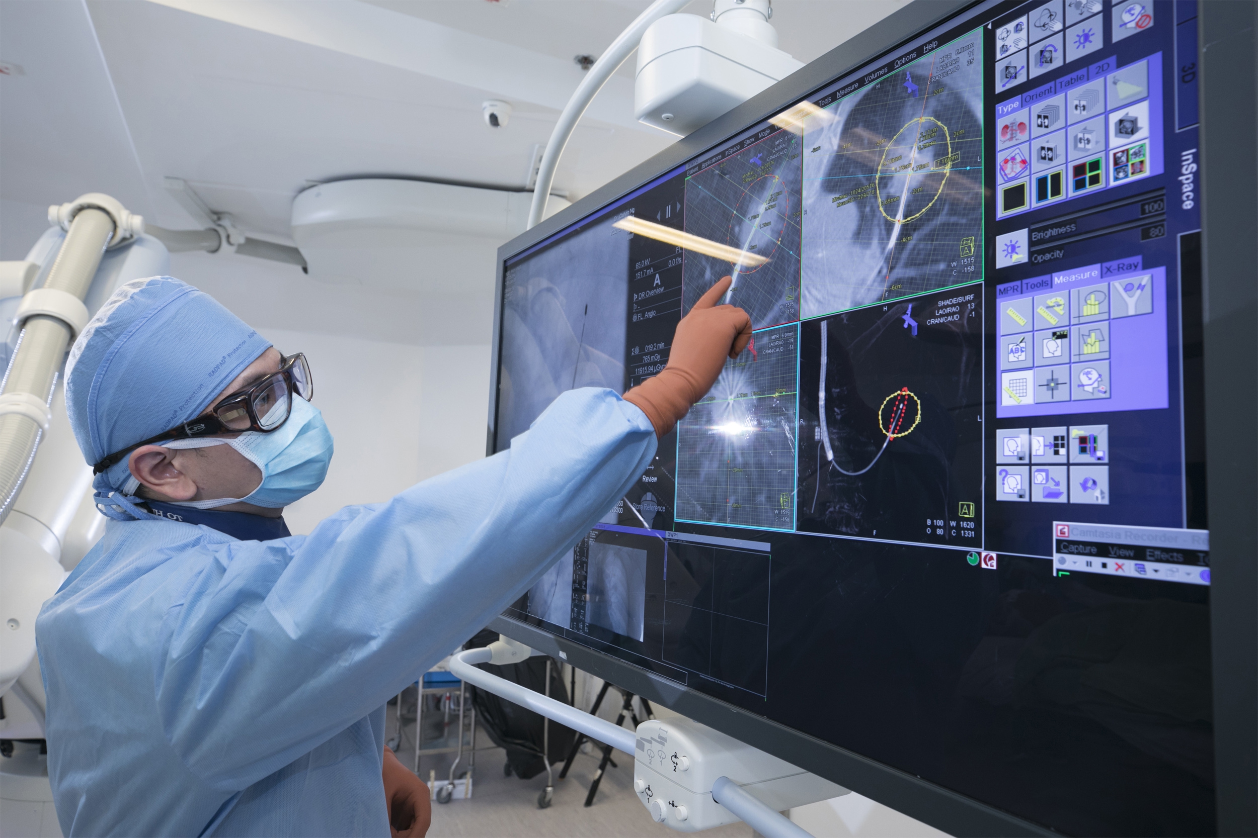 The actual scene showing BMA of lung tumours in the hybrid operating room. The photos show the confirmation of adequate ablation of cancer cells through advanced evaluation of CT images.