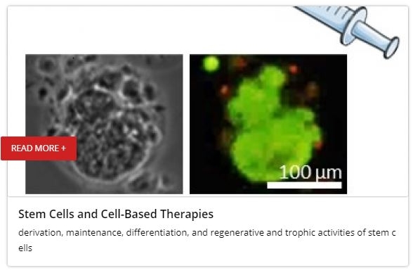 Stem Cells and Cell-Based Therapies