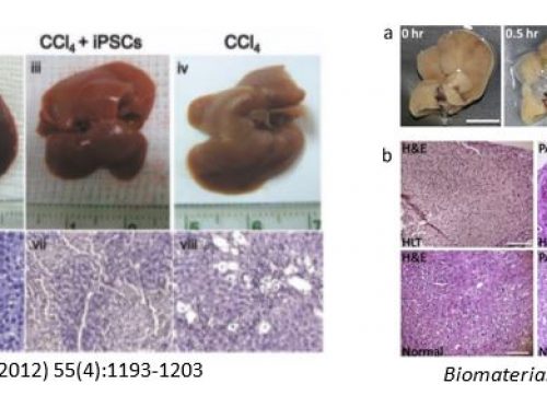 MSCs Isolation and Hepatic Tissue Engineering