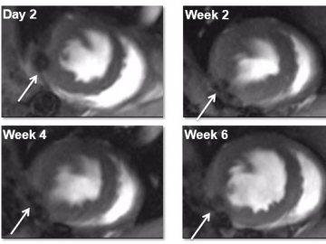 Stem Cells and Cell-Based Therapies - Big