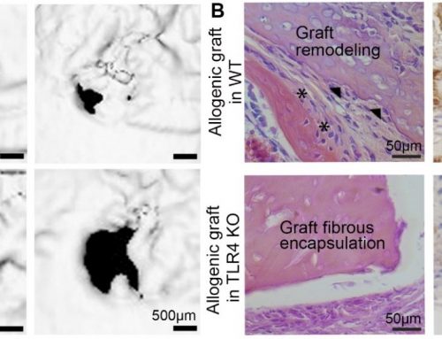 Immunomodulation for Enhanced Fracture Repair