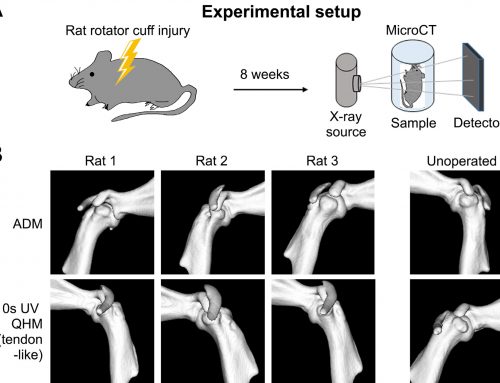 Scientific Sharing by Prof. Elmer Ker & Prof. Michelle Wang – Growth and differentiation factor-7 immobilized, mechanically strong quadrol-hexamethylene diisocyanate-methacrylic anhydride polyurethane polymer for tendon repair and regeneration