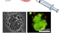 Stem Cells and Cell-Based Therapies