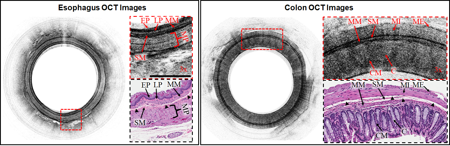 esophagus and colon OCT