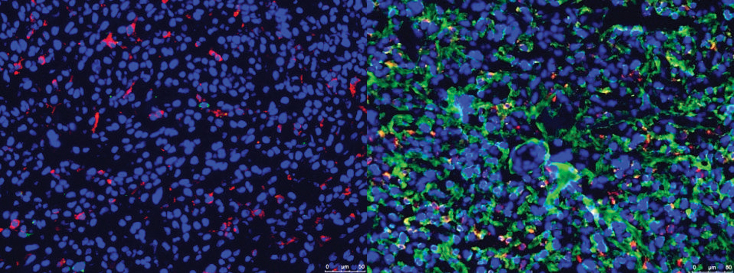 Visuals of Mincle-targeted plasmids (left) and how they look under the ultrasound-mediated microbubble system (right) <em>(courtesy of interviewee)</em>