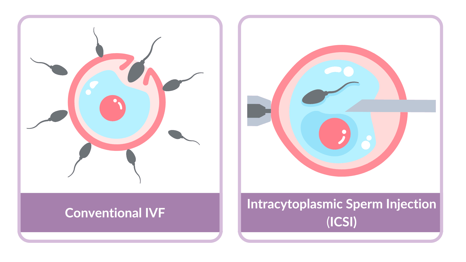 Conventional IVF_ ICSI - Eng.png