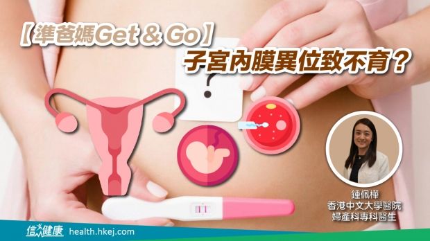 【準爸媽Get & Go】子宮內膜異位致不育？.jpg
